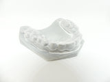 DENTIFIX HR 1L GRISE (modèle dentaire) - wanhao france